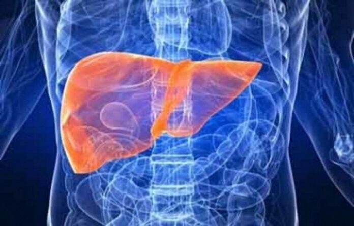 Hepatitis C, enfermedad silenciosa con daños irreversibles Hepatitis C, enfermedad silenciosa con daños irreversibles
