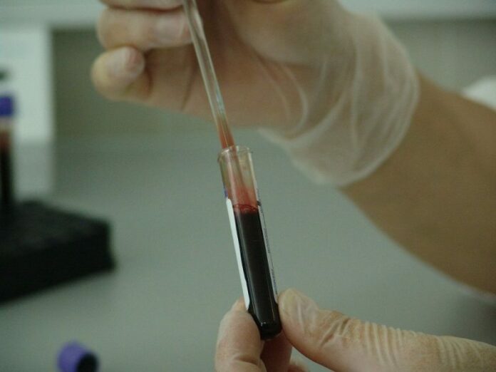 Población de escasos ingresos, con mayor riesgo a morir de cáncer Población de escasos ingresos, con mayor riesgo a morir de cáncer