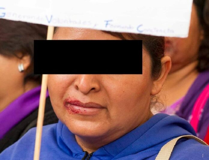 Derechos Humanos llama a combatir la violencia hacia las mujeres Derechos Humanos llama a combatir la violencia hacia las mujeres