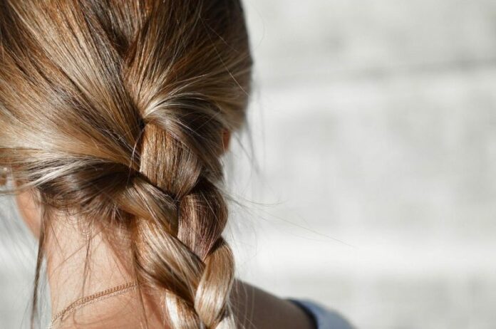Trenzas, extensiones y tratamientos pueden causar calvicie Trenzas, extensiones y tratamientos pueden causar calvicie