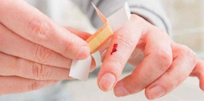 Afecta hemofilia a seis mil mexicanos, señala IMSS Afecta hemofilia a seis mil mexicanos, señala IMSS