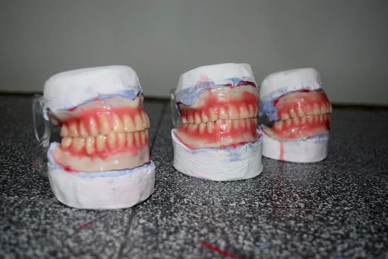 DIF Estatal hizo entrega de 50 prótesis dentales